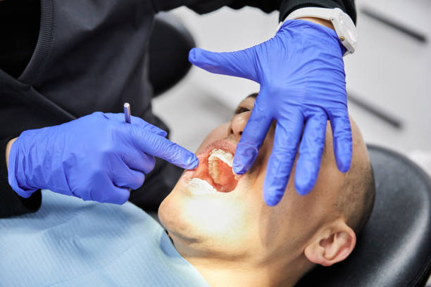 Best Emergency Root Canal Treatment in Hugoton, KS